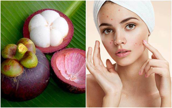 bi quyet chong lao hoa voi mang cut 3