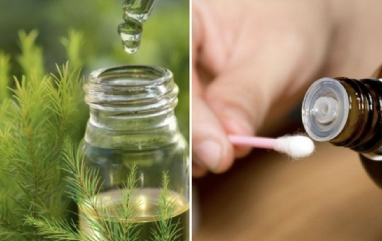 tips dieu tri mun an 3