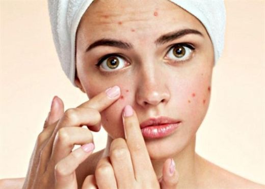 mach ban 5 cach an sau rieng khong noi mun nong trong nguoi 2