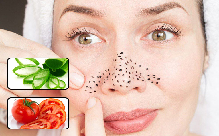 3 cach tri mun dau den cuc ki hieu qua tai nha 2